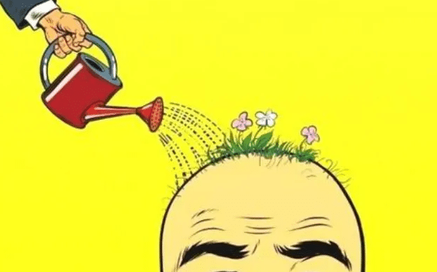 植發(fā)