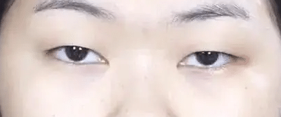小眼睛+高眉骨 小眼睛+高眉骨