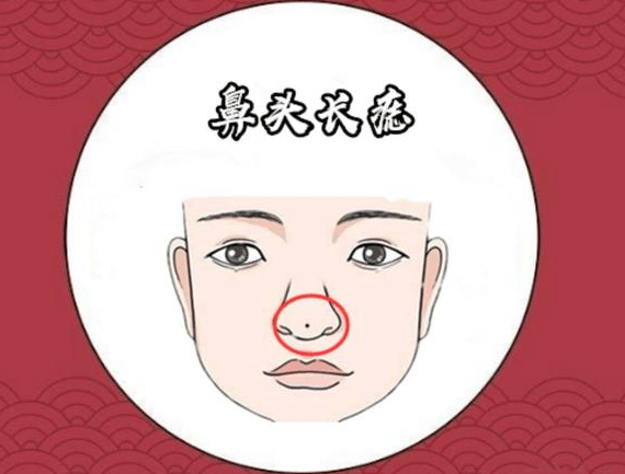 女性鼻子痣臉相分析！鼻子痣的位置與命運有什么關(guān)系？