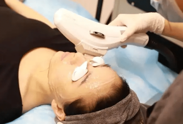 光子嫩膚