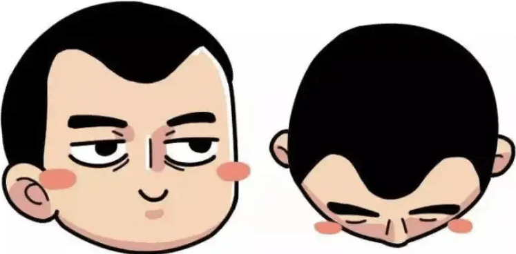 M型脫發(fā)
