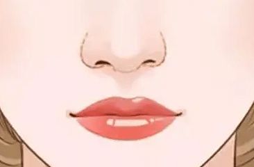 鼻翼縮小手術