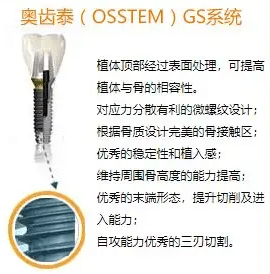 韓國奧齒泰