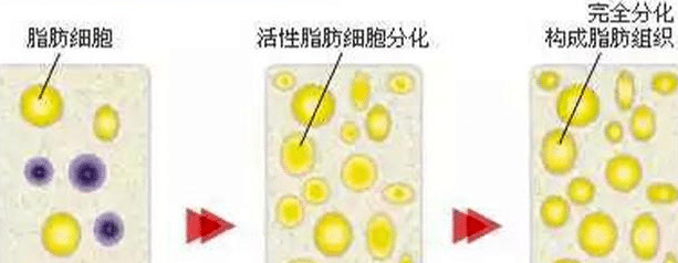 自體脂肪恢復(fù)時期