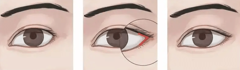 開(kāi)眼尾