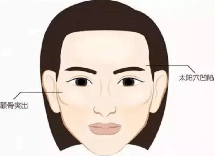 太陽穴凹陷