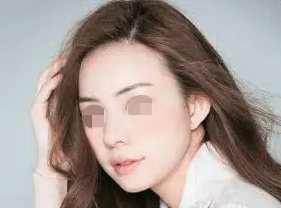 發(fā)際線種植