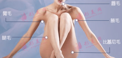 激光脫毛