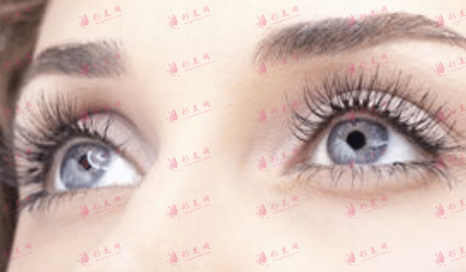 雙眼皮 雙眼皮