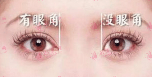 開眼角 開眼角