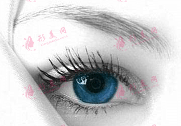 內(nèi)眥贅皮