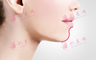 豐下巴