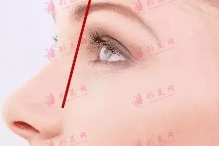 眼窩凹陷