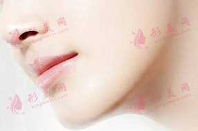 豐下巴
