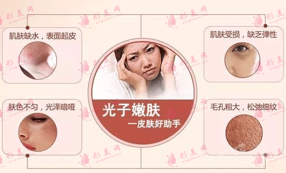 光子嫩膚
