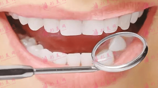 牙齒治療