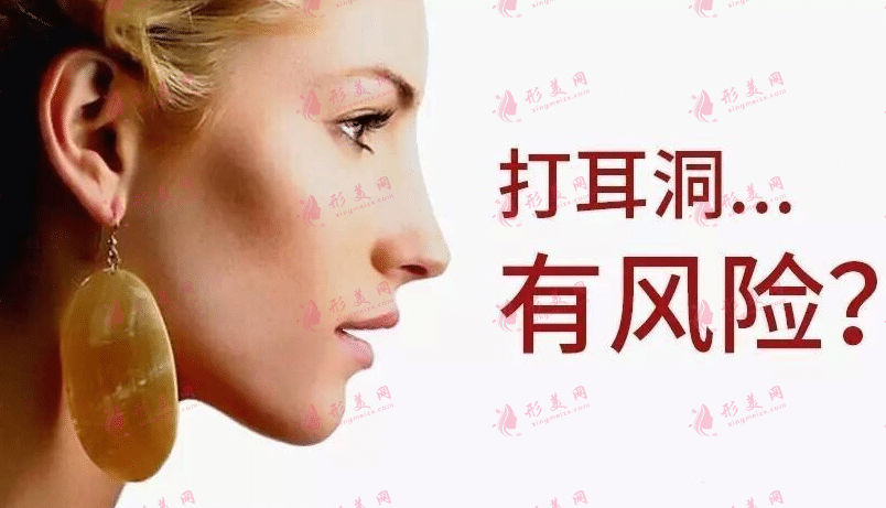 穿耳孔術 穿耳孔術