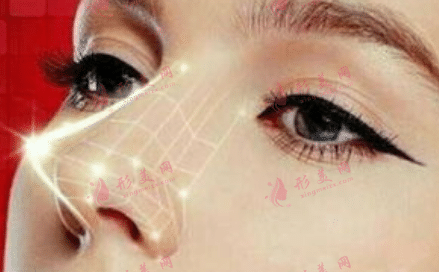 假體隆鼻 假體隆鼻