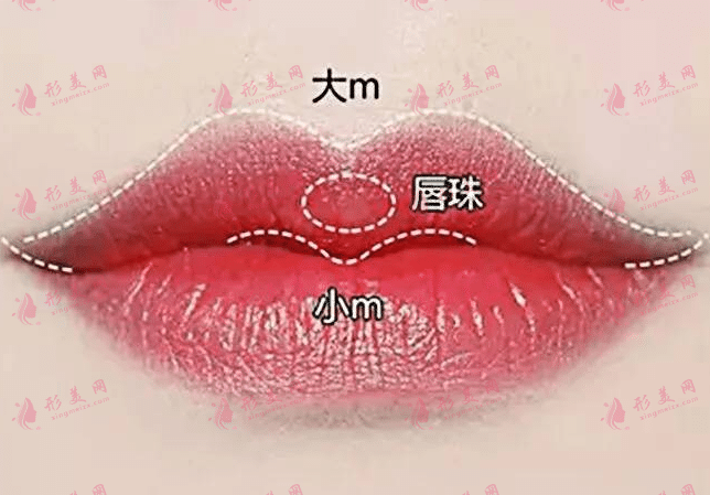 唇珠成形
