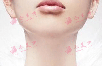脖子除皺