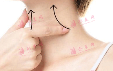 脖子除皺