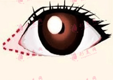 開眼角