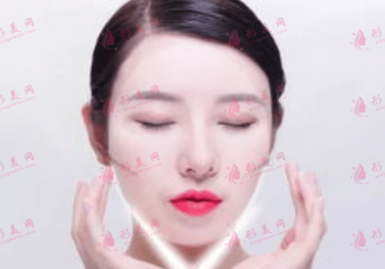 面部吸脂