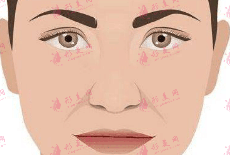 法令紋