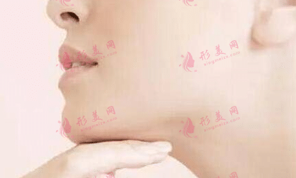 雙下巴