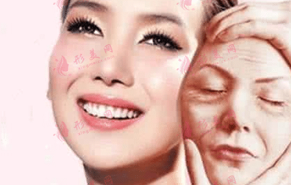 蘋(píng)果肌拉皮
