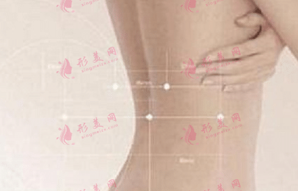 背部抽脂手術