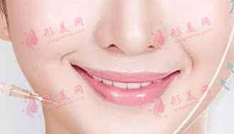 瘦臉針