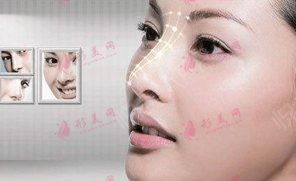 歪鼻矯正
