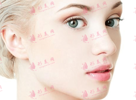 鼻翼縮小