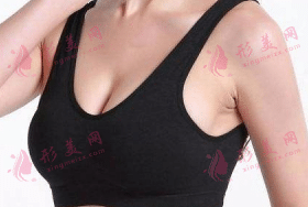豐胸