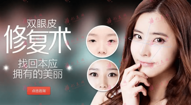 雙眼皮失敗修復(fù)方法有哪些?