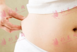 剖腹產(chǎn)后的腰間贅肉