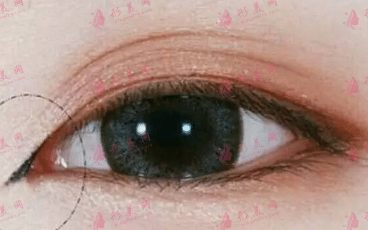 開眼角