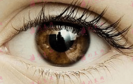 開(kāi)內(nèi)眼角