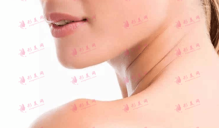頸紋是怎么造成的？如何預(yù)防和去除頸紋？