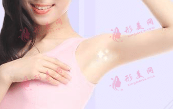 激光脫腋毛