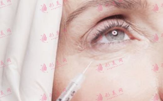 皺紋