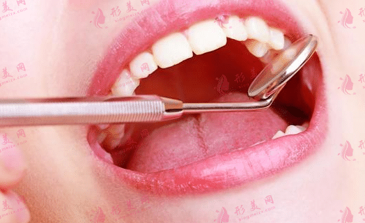 口腔治療