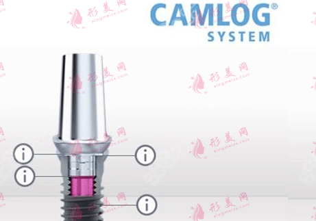 Camlog種植體