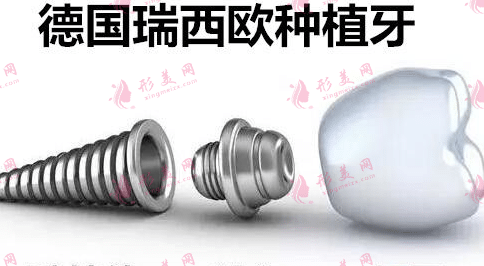 德國(guó)ht瑞西歐種植體