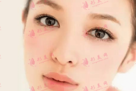 自體脂肪豐臉頰