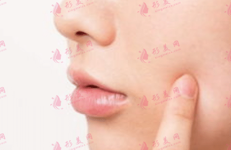自體脂肪移植