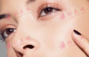 鼻頭縮小