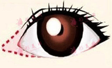開(kāi)眼角 開(kāi)眼角
