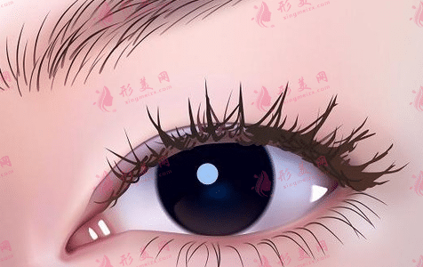 開眼角